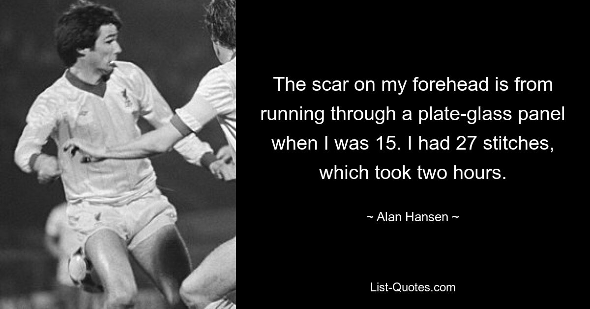 The scar on my forehead is from running through a plate-glass panel when I was 15. I had 27 stitches, which took two hours. — © Alan Hansen