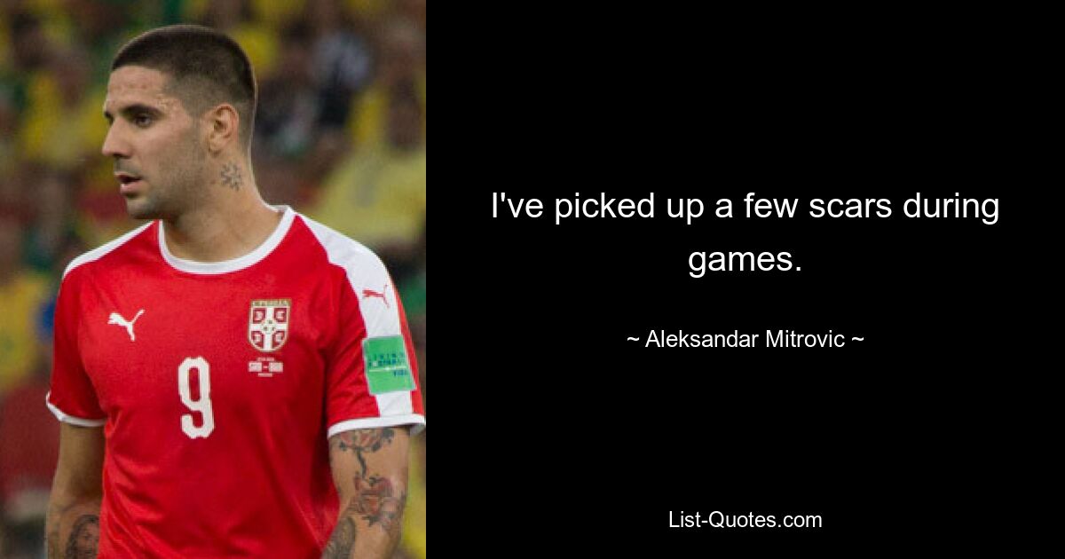 I've picked up a few scars during games. — © Aleksandar Mitrovic