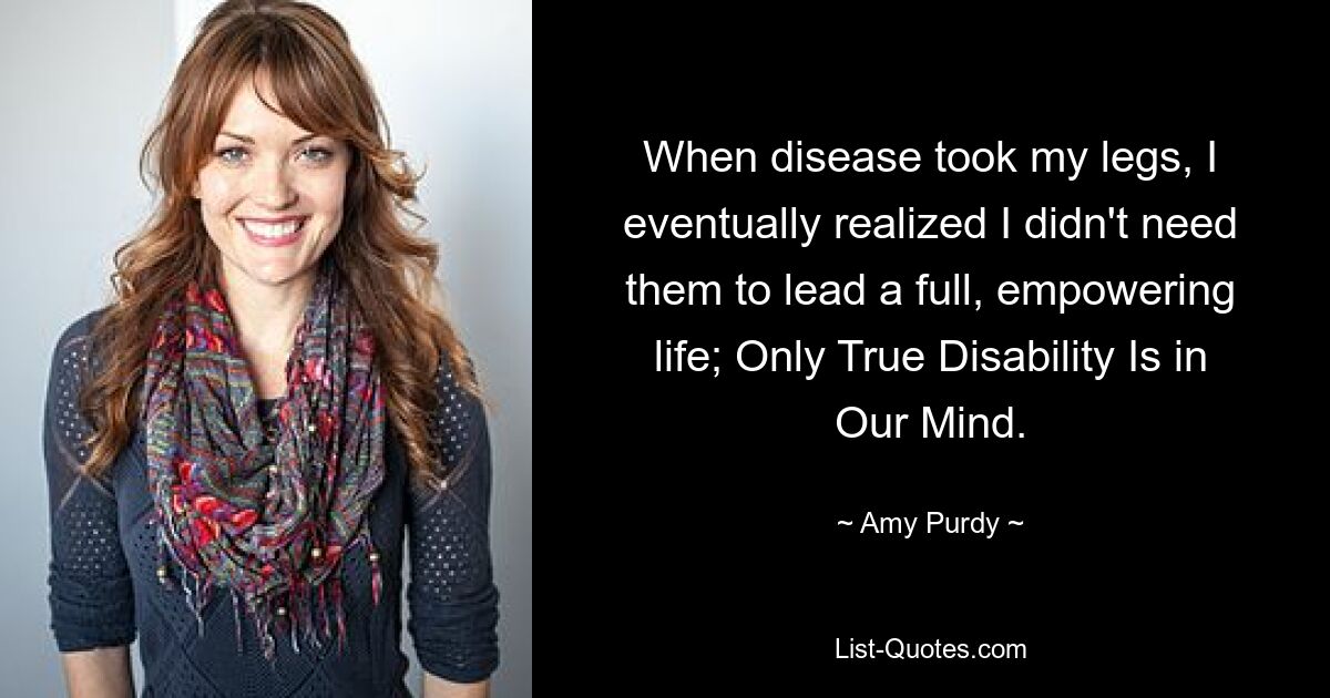 When disease took my legs, I eventually realized I didn't need them to lead a full, empowering life; Only True Disability Is in Our Mind. — © Amy Purdy