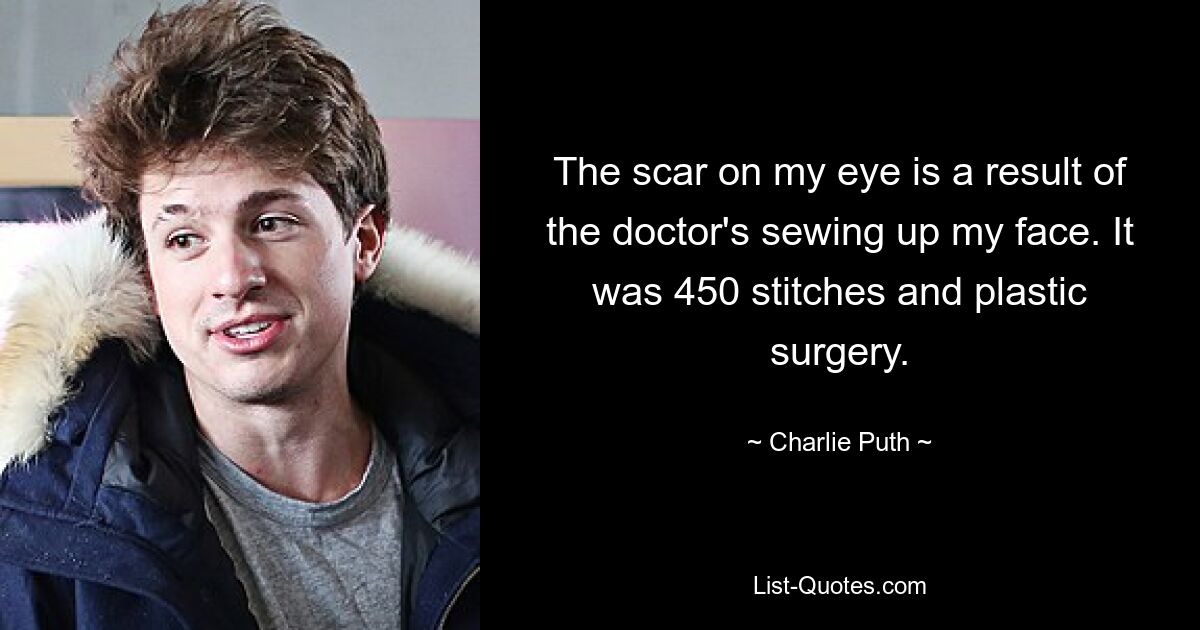 The scar on my eye is a result of the doctor's sewing up my face. It was 450 stitches and plastic surgery. — © Charlie Puth