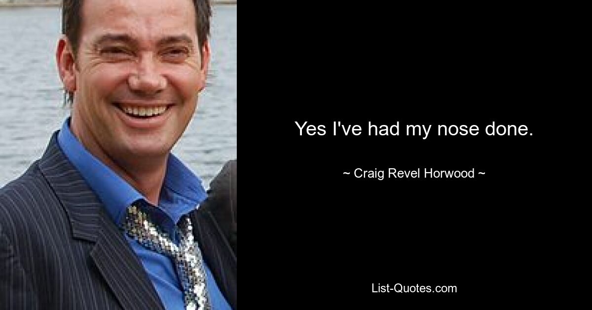 Yes I've had my nose done. — © Craig Revel Horwood