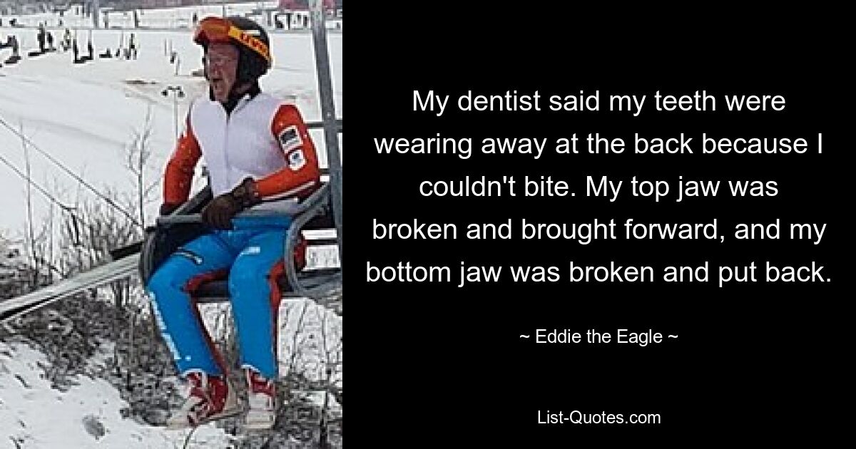 My dentist said my teeth were wearing away at the back because I couldn't bite. My top jaw was broken and brought forward, and my bottom jaw was broken and put back. — © Eddie the Eagle