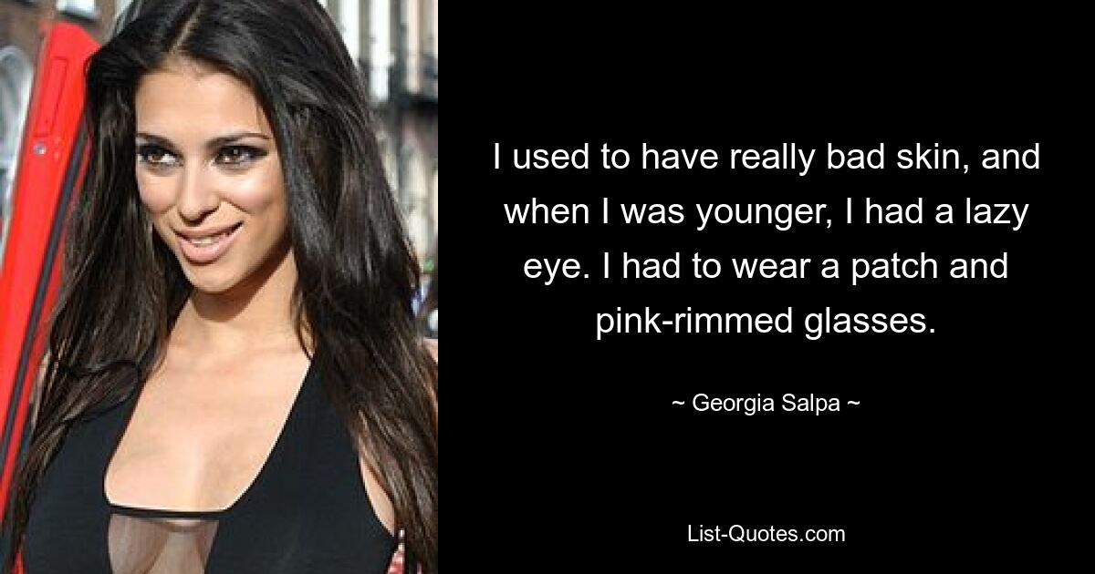 I used to have really bad skin, and when I was younger, I had a lazy eye. I had to wear a patch and pink-rimmed glasses. — © Georgia Salpa