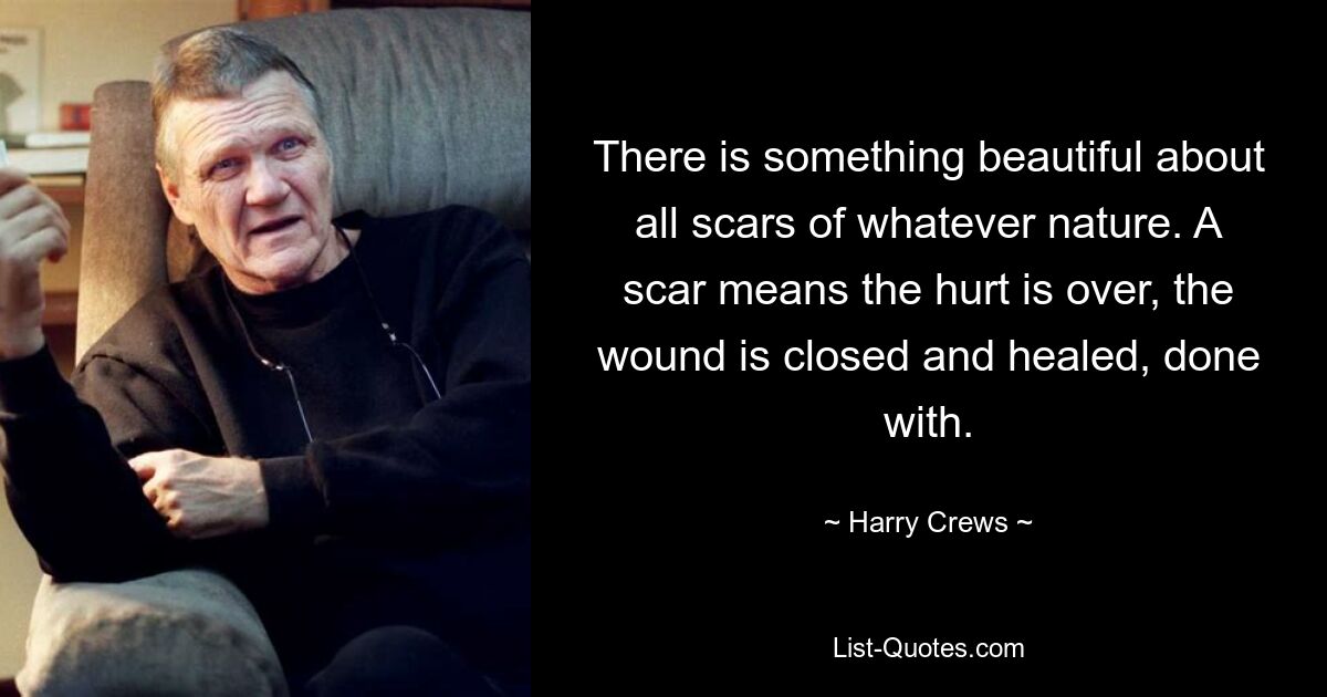 There is something beautiful about all scars of whatever nature. A scar means the hurt is over, the wound is closed and healed, done with. — © Harry Crews