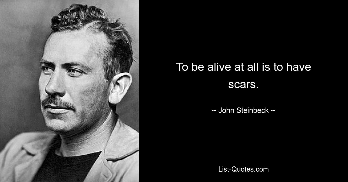 To be alive at all is to have scars. — © John Steinbeck