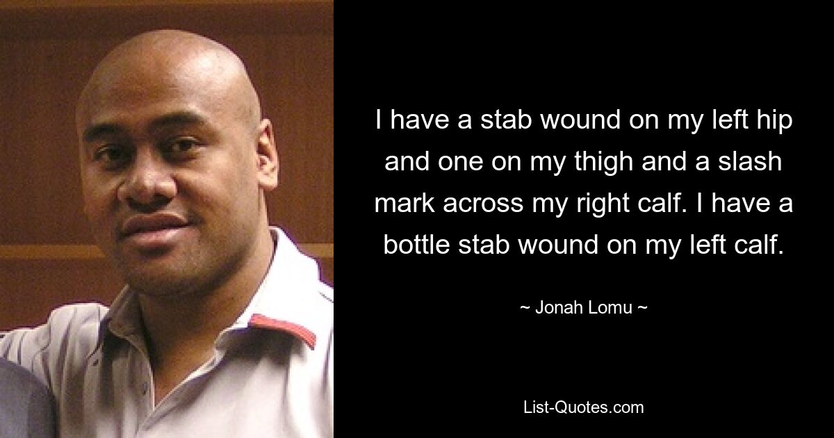 I have a stab wound on my left hip and one on my thigh and a slash mark across my right calf. I have a bottle stab wound on my left calf. — © Jonah Lomu