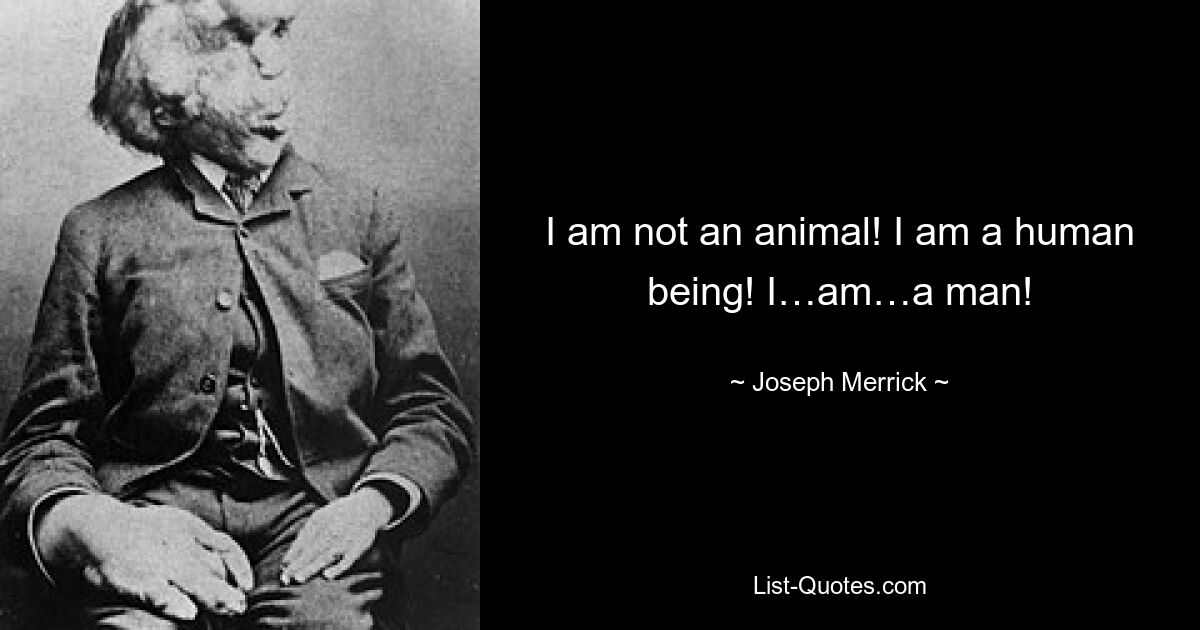 I am not an animal! I am a human being! I…am…a man! — © Joseph Merrick