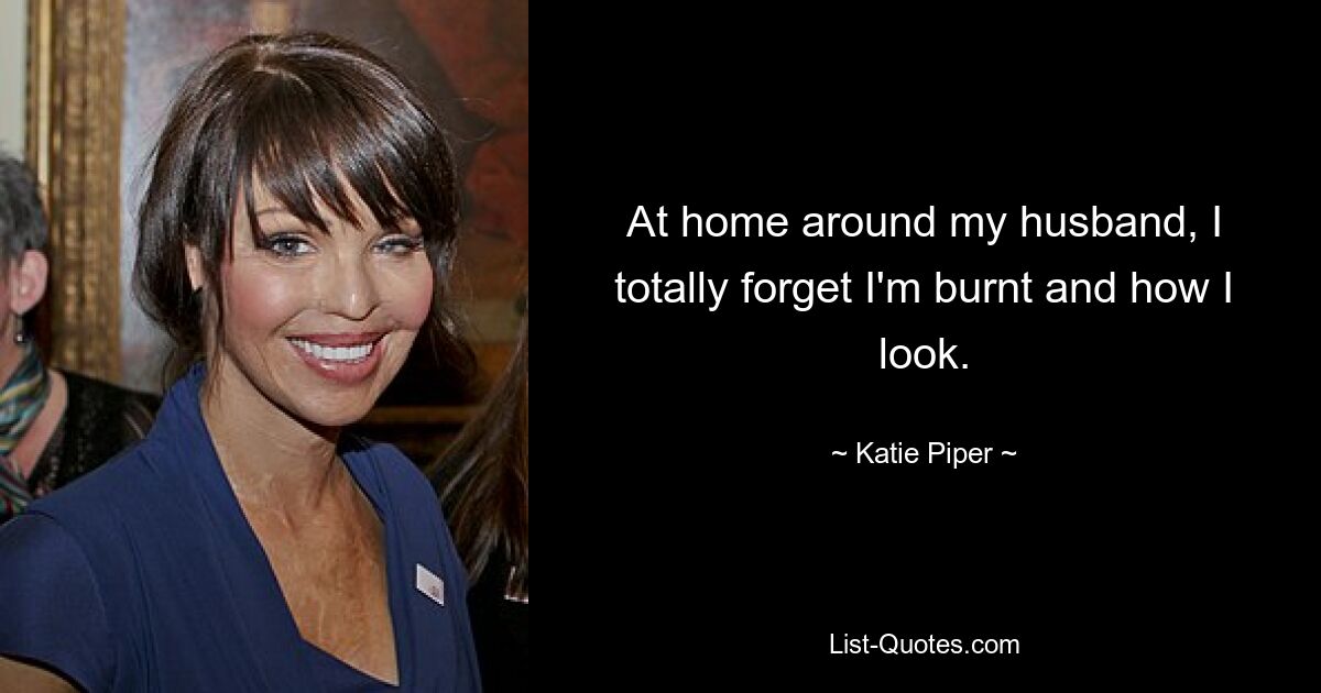 At home around my husband, I totally forget I'm burnt and how I look. — © Katie Piper