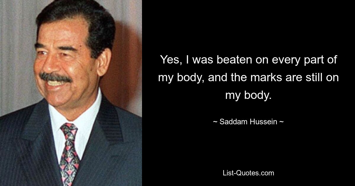 Yes, I was beaten on every part of my body, and the marks are still on my body. — © Saddam Hussein