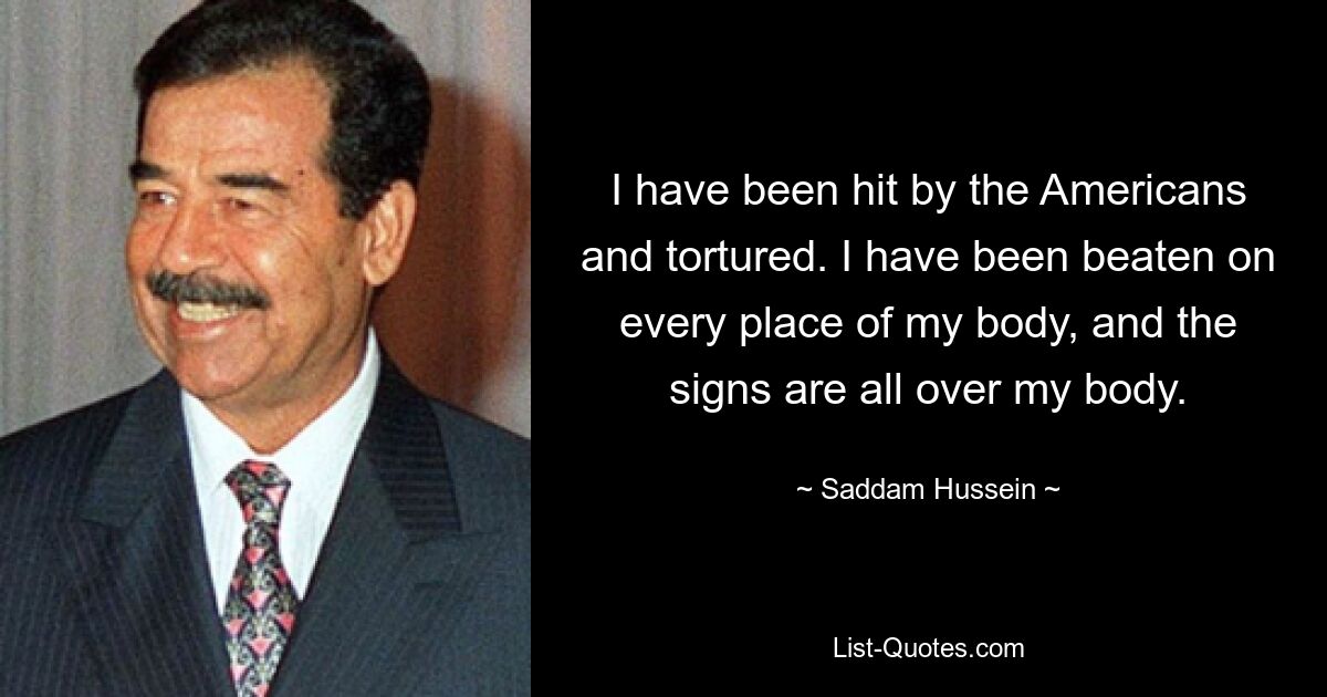 I have been hit by the Americans and tortured. I have been beaten on every place of my body, and the signs are all over my body. — © Saddam Hussein