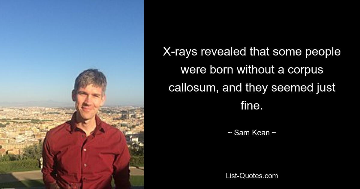 X-rays revealed that some people were born without a corpus callosum, and they seemed just fine. — © Sam Kean