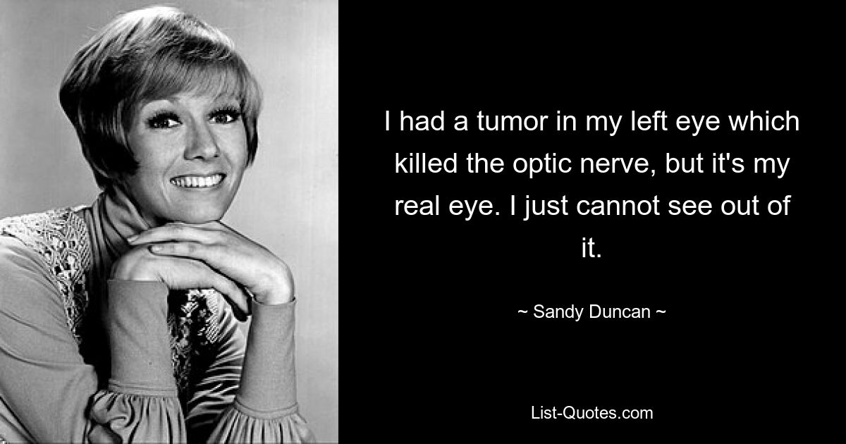 I had a tumor in my left eye which killed the optic nerve, but it's my real eye. I just cannot see out of it. — © Sandy Duncan