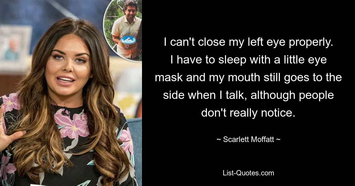 I can't close my left eye properly. I have to sleep with a little eye mask and my mouth still goes to the side when I talk, although people don't really notice. — © Scarlett Moffatt