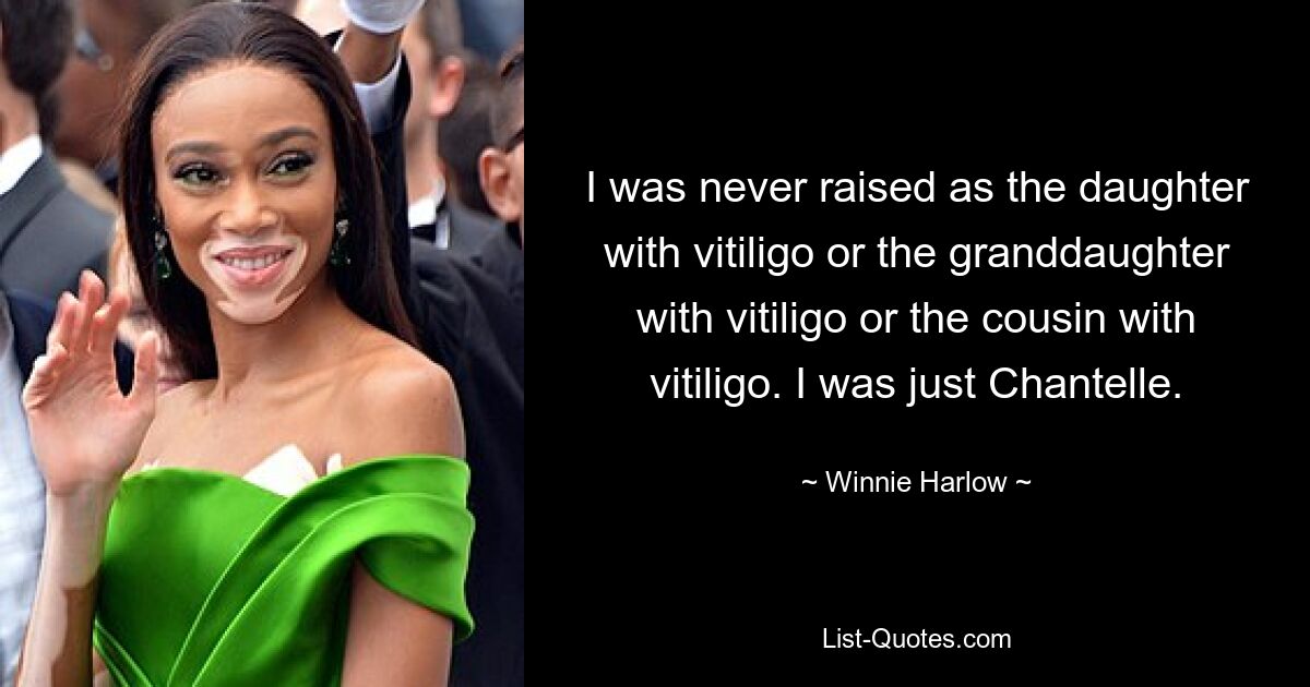 I was never raised as the daughter with vitiligo or the granddaughter with vitiligo or the cousin with vitiligo. I was just Chantelle. — © Winnie Harlow