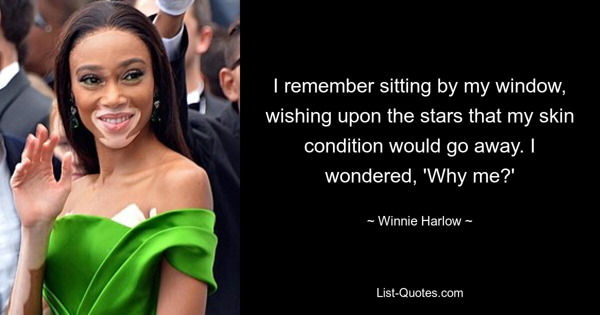 I remember sitting by my window, wishing upon the stars that my skin condition would go away. I wondered, 'Why me?' — © Winnie Harlow