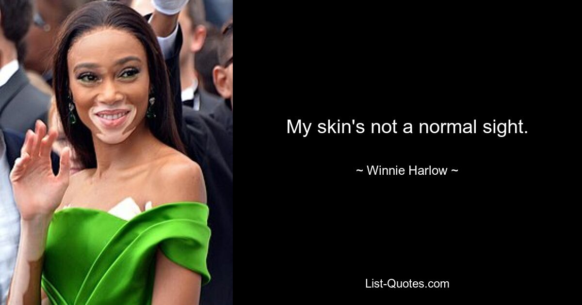 My skin's not a normal sight. — © Winnie Harlow